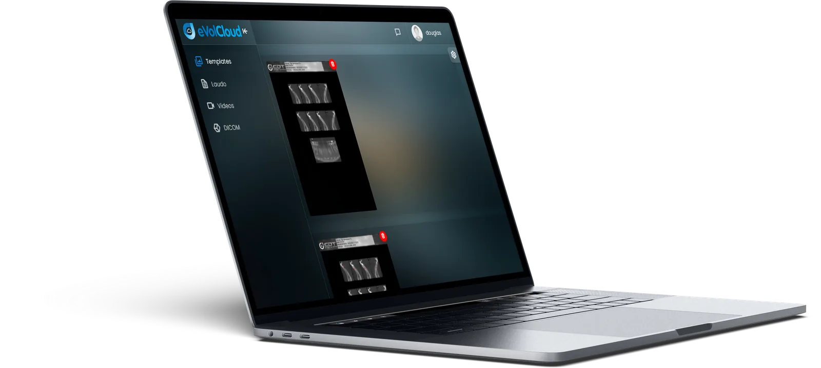 Interface do eVolCloud em um notebook